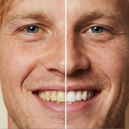 ✨ Azonnali fogfehérítő fogkrém — Az eredmények azonnal láthatók! 5 ml-es kiszerelés, hosszú eltarthatóság! 😁🦷