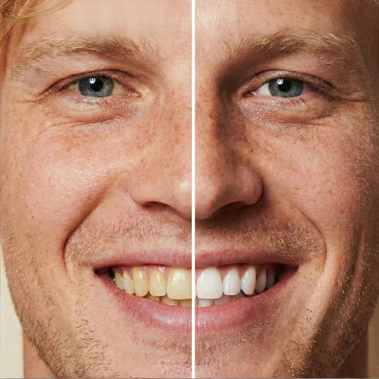 ✨ Azonnali fogfehérítő fogkrém — Az eredmények azonnal láthatók! 5 ml-es kiszerelés, hosszú eltarthatóság! 😁🦷