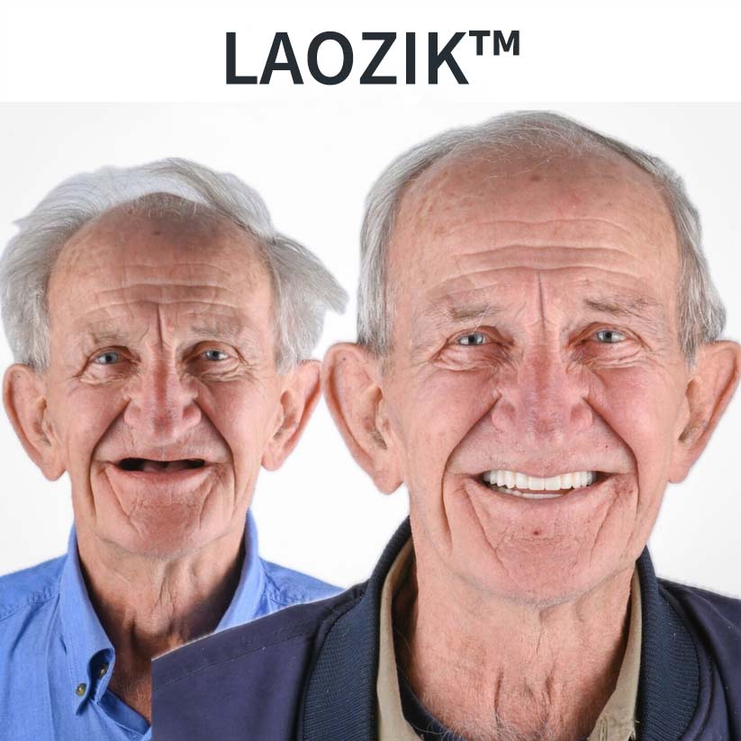 AdaptableFit funkcionális protézisek