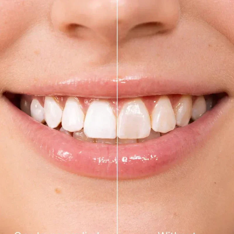 ✨ Azonnali fogfehérítő fogkrém — Az eredmények azonnal láthatók! 5 ml-es kiszerelés, hosszú eltarthatóság! 😁🦷