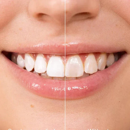 ✨ Azonnali fogfehérítő fogkrém — Az eredmények azonnal láthatók! 5 ml-es kiszerelés, hosszú eltarthatóság! 😁🦷