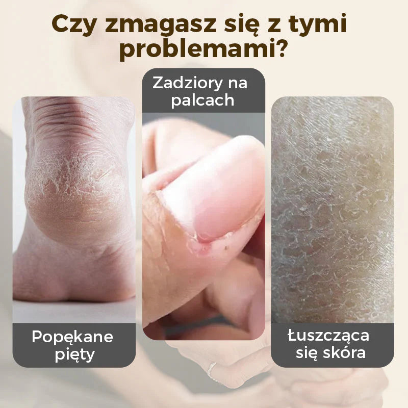 🎁💥Intenzíven regeneráló balzsam repedezett sarkakra és száraz kézre